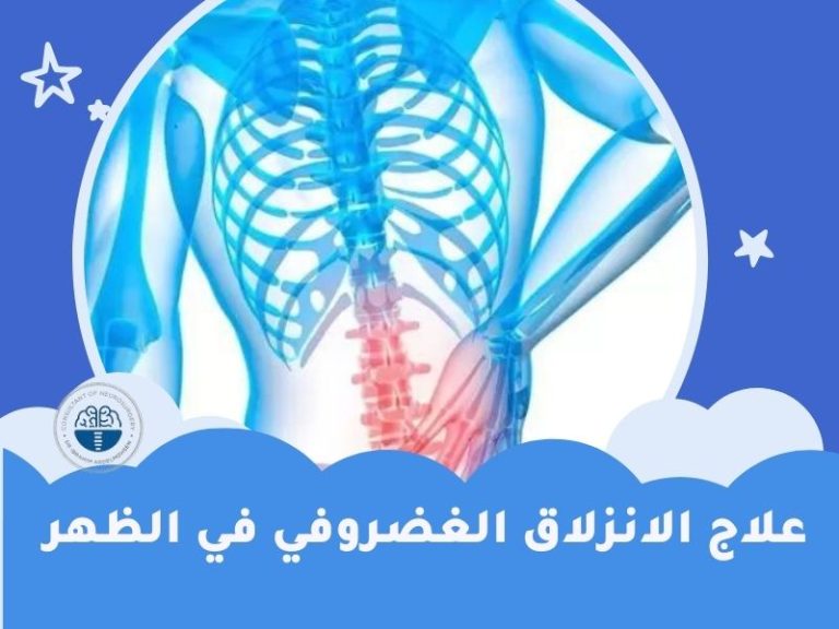 افضل دكتور لعلاج الانزلاق الغضروفي في مصر